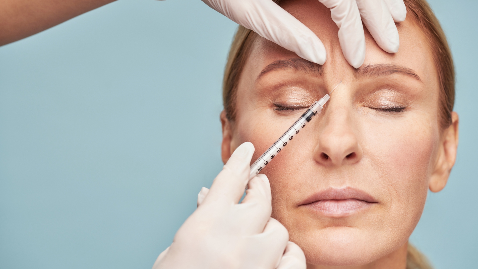 glabella injectie botox
